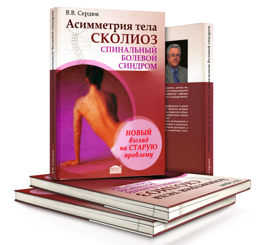 Body Asymmetry. Scoliosis — First Edition