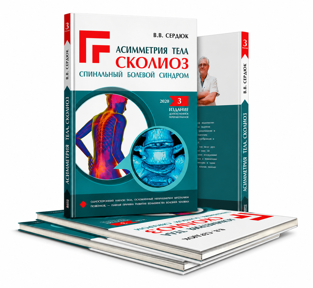 Body Asymmetry. Scoliosis. Spinal Pain Syndrome — Third Edition